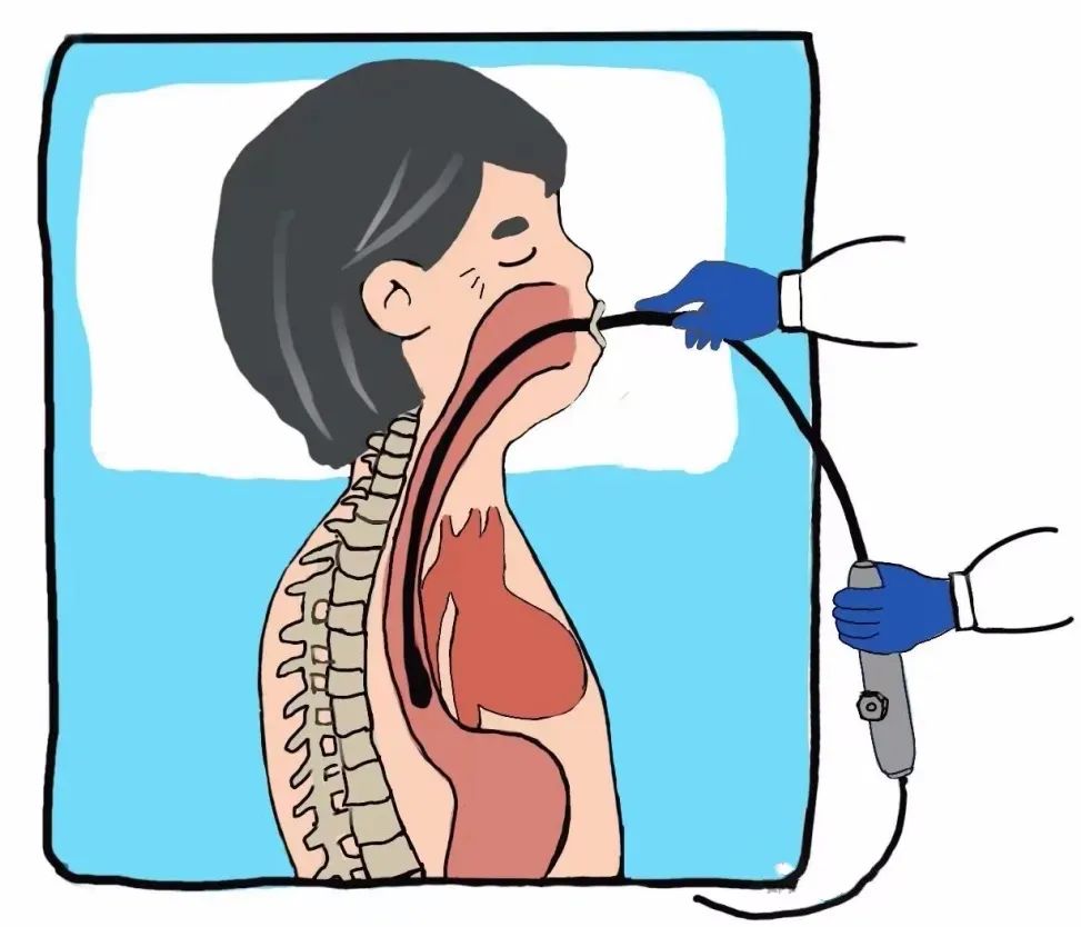 小探頭看大病 | 經(jīng)食道超聲立大功！