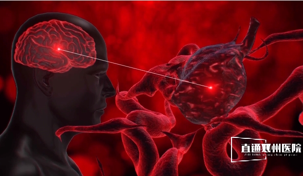 【直通襄州醫(yī)院?】夾閉腦動脈瘤 顯微鏡下的毫米級操作